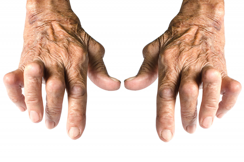 Man with osteoporosis in hand